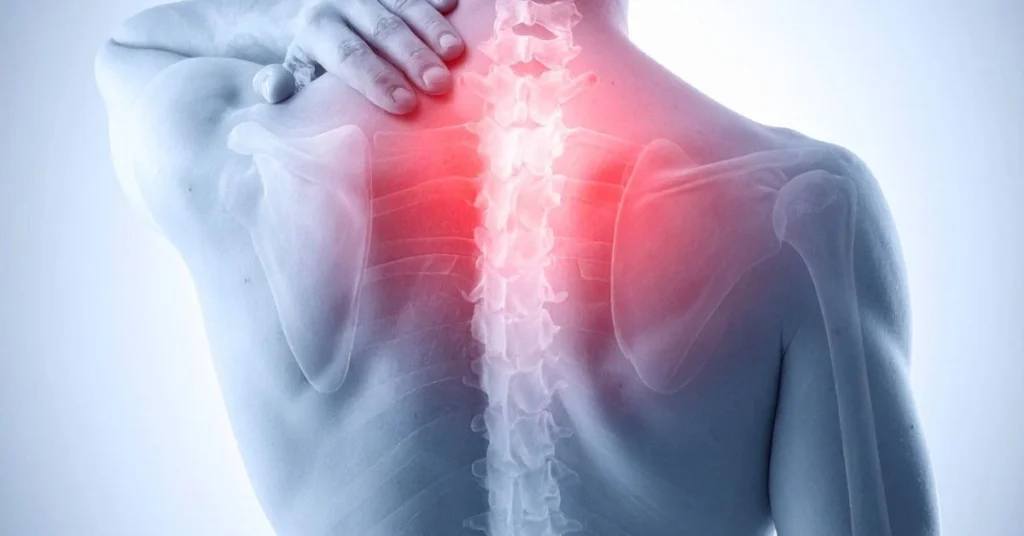 Dolor de Espalda Alta: Causas Comunes y Qué Hacer